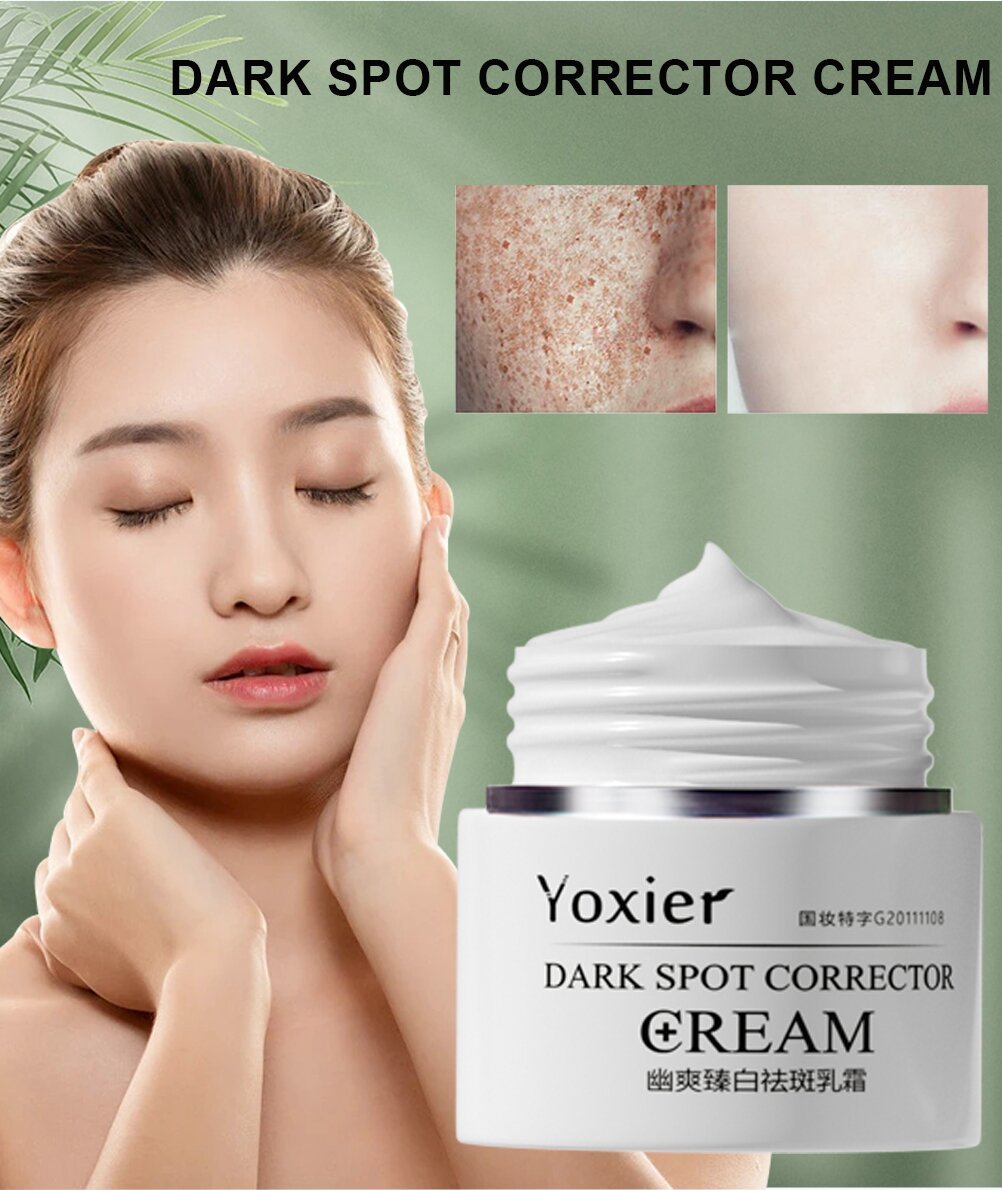 "Yoxier Dark Spot Corrector Cream – Brighten and Even Skin Tone"