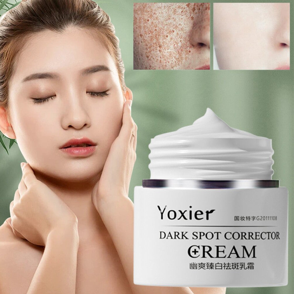 "Yoxier Dark Spot Corrector Cream – Brighten and Even Skin Tone"