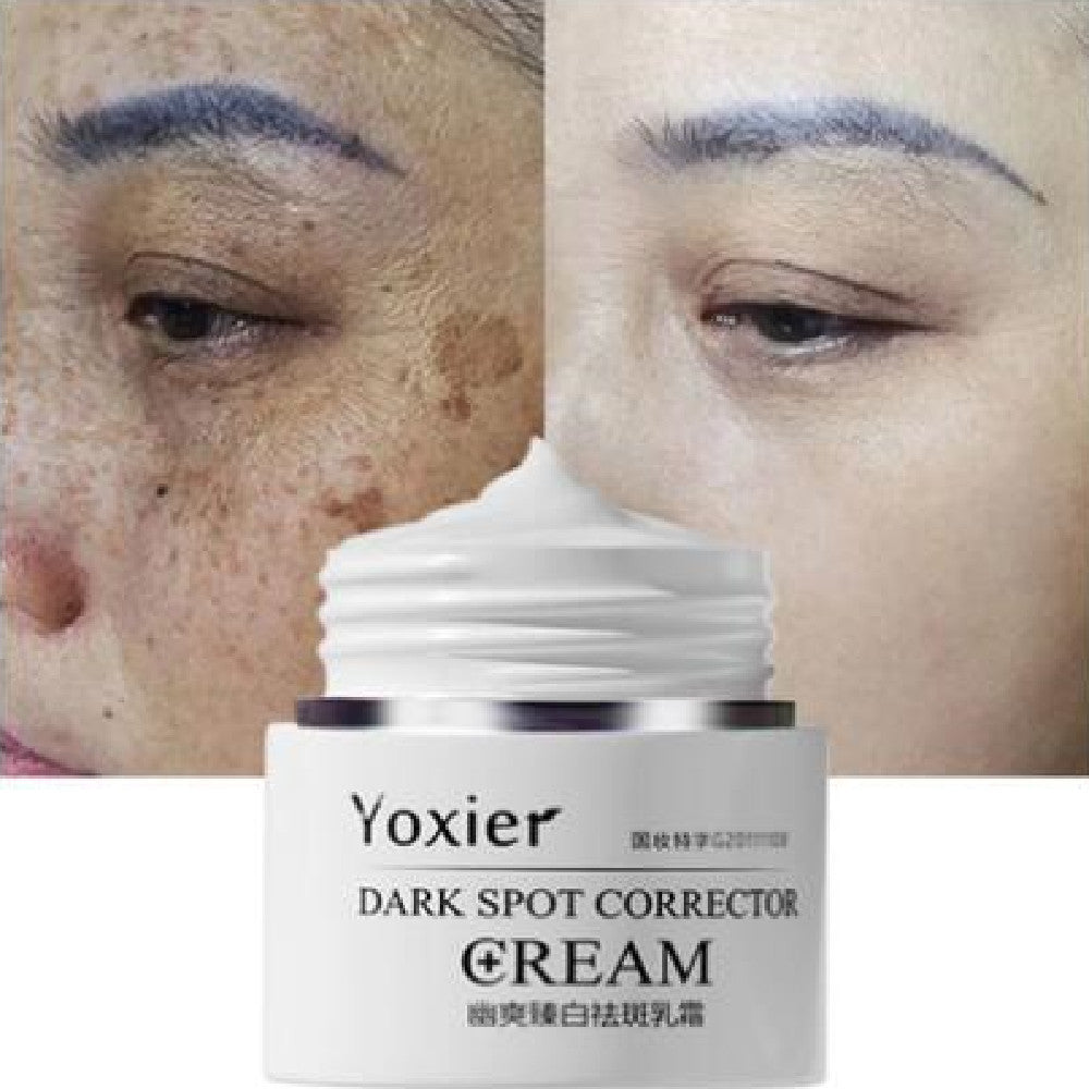 "Yoxier Dark Spot Corrector Cream – Brighten and Even Skin Tone"